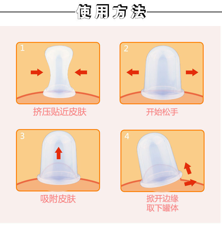 2號硅膠拔火罐 2號硅膠拔火罐
